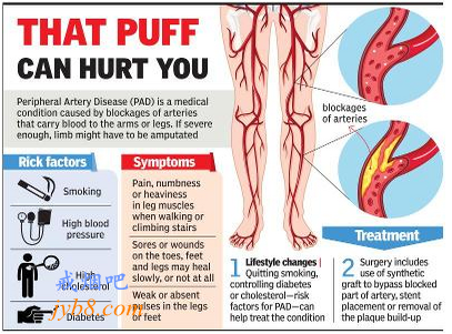 吸烟可以让你失去一条腿